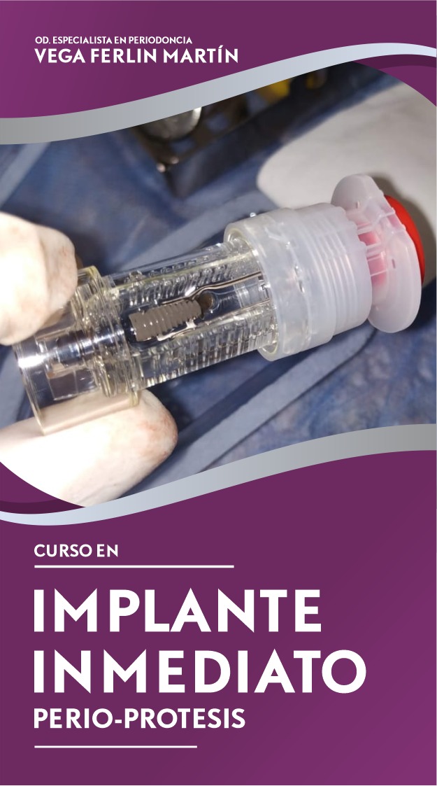 Escuela de Mejoramiento Profesional, del Círculo Odontológico de San Luis, te invita a conocer e inscribirte, al curso de: IMPLANTE INMEDIATO