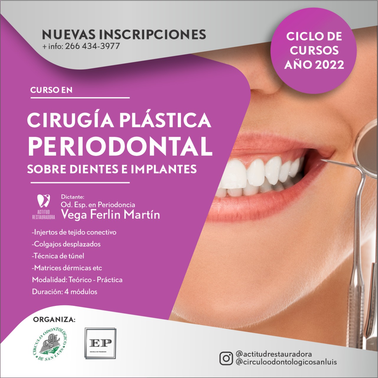 CURSO DE CIRUGÍA PLÁSTICA PERIODONTAL A CARGO DEL DR VEGA FERLIN