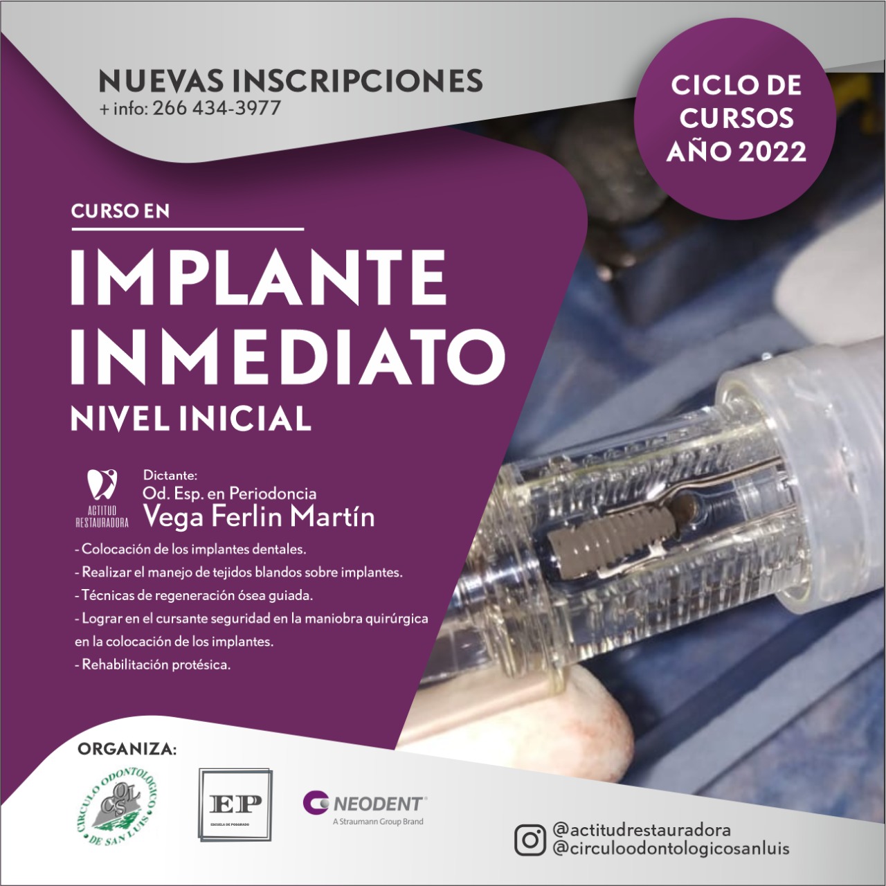 CURSO DE IMPLANTE INMEDIATO A CARGO DEL DR VEGA FERLIN